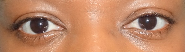 benefit roller lash before and after